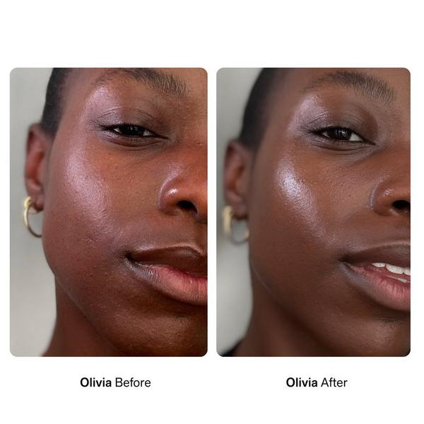 Nimbi Pillow Slip Dermaplaner Facial Oil #8