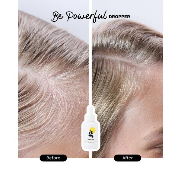 Ginger Milk Anti-Hair Loss Dropper Strength & Growth With Biotin & Apigenin #3