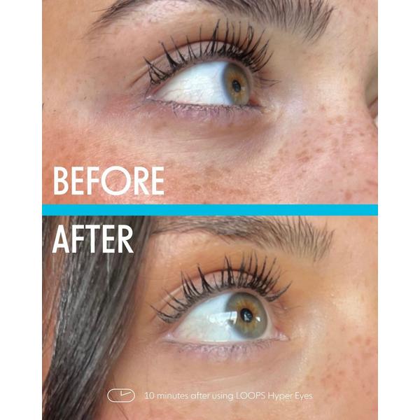 LOOPS Hyper Eyes Dark Circles Hydrogel Eye Mask Set #5