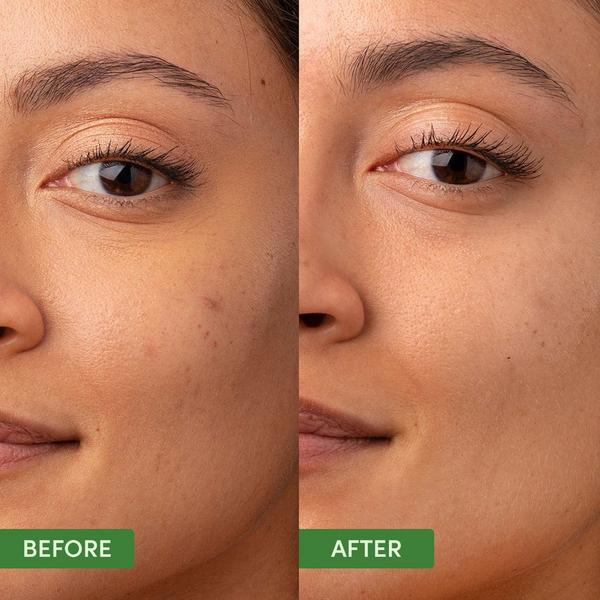 Sand and Sky Oil Control Skin Balancing Kit #4