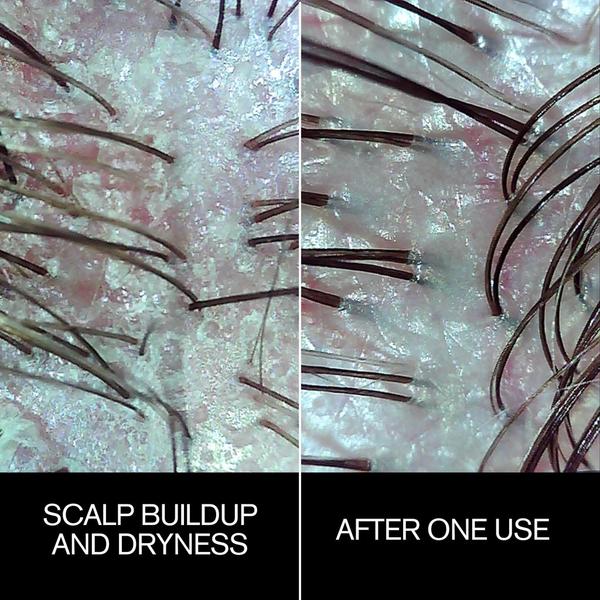 Najeau Follicle Drops #3