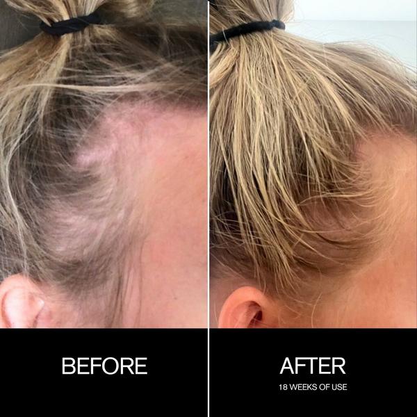 Najeau Follicle Drops #4