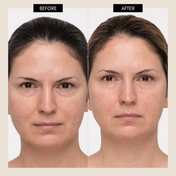 7 E Wellness Mini Microcurrent Home Care Kit #2