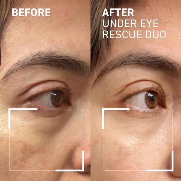 Dr. Brandt Eye Puffiness & Fatigue Duo #6