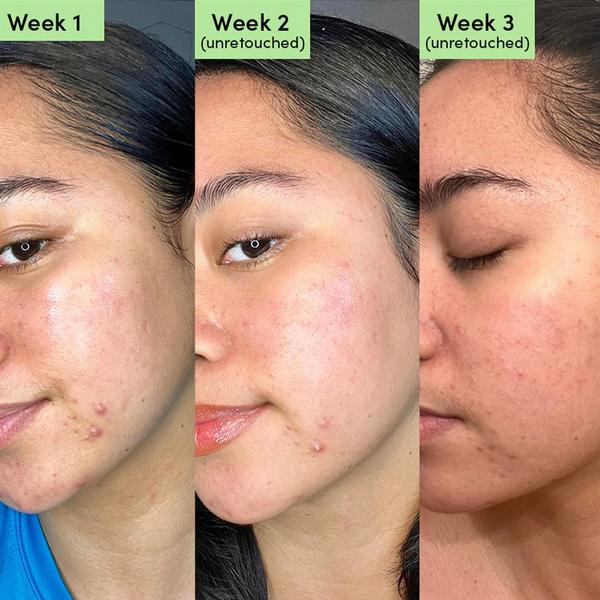 Sand and Sky Oil Control Clearing Face Mask #3