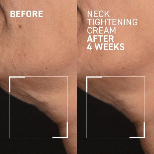 Dr. Brandt Neck Tightening Cream + Gua Sha #3