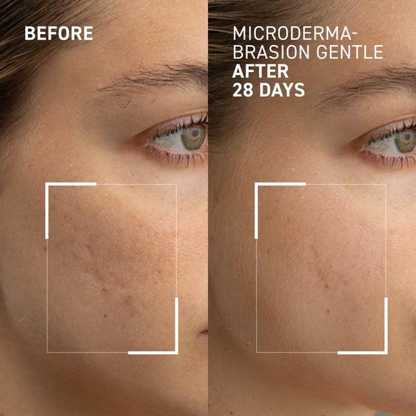 Dr. Brandt Gentle Microdermabrasion Face Exfoliator #3