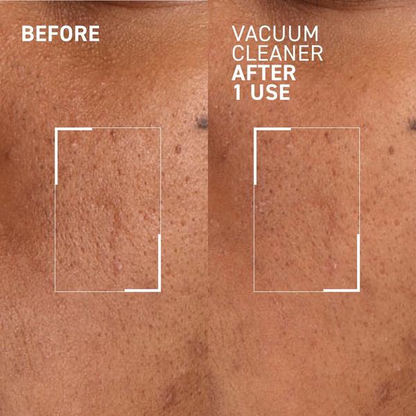 Dr. Brandt Vacuum Cleaner #2