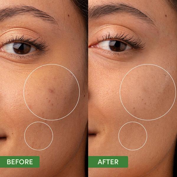 Sand and Sky Oil Control Clearing Moisturiser #3