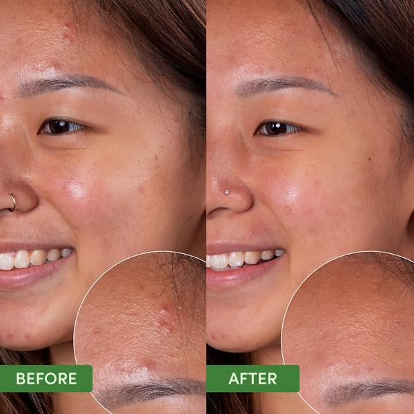 Sand and Sky Oil Control Clearing Cleanser #3