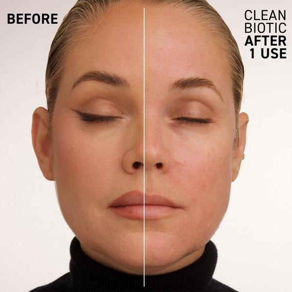 Dr. Brandt Clean Biotic #2