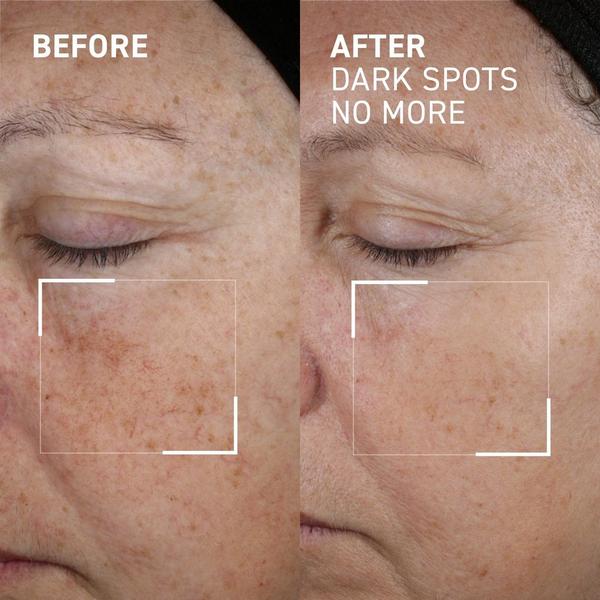 Dr. Brandt Dark Spots No More #2