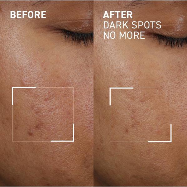 Dr. Brandt Dark Spots No More #3