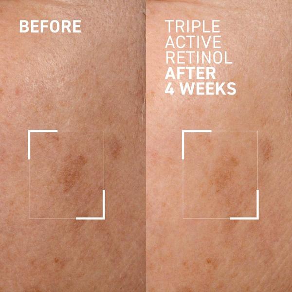 Dr. Brandt Triple Active Retinol #2