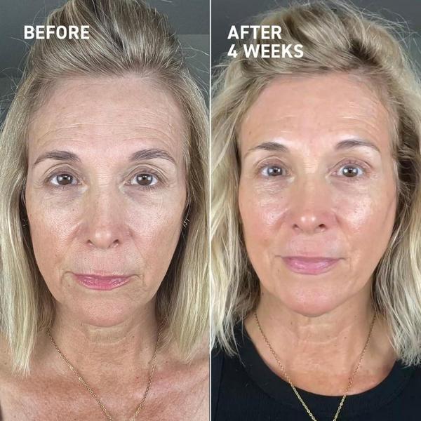 Dr. Brandt Dermal Micro Points #2