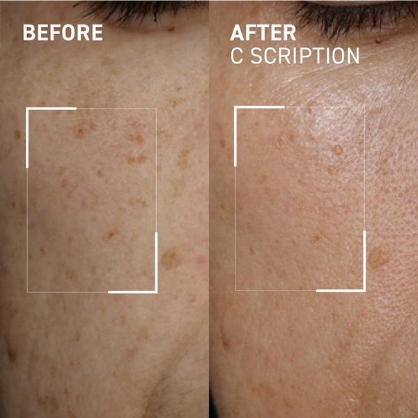 Dr. Brandt C Scription #2