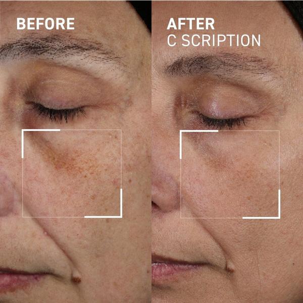 Dr. Brandt C Scription #3