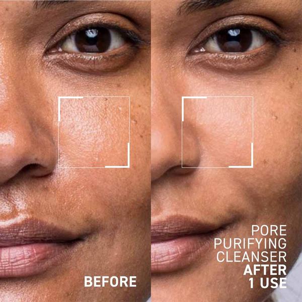 Dr. Brandt Pore Purifying Cleanser #2