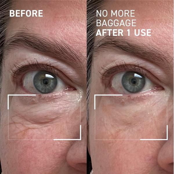 Dr. Brandt No More Baggage #2