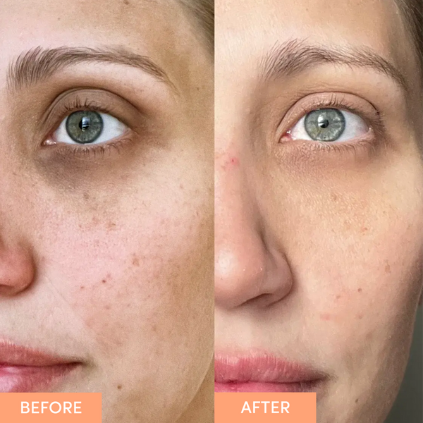 Sand and Sky Anti-Aging Eye Cream #3