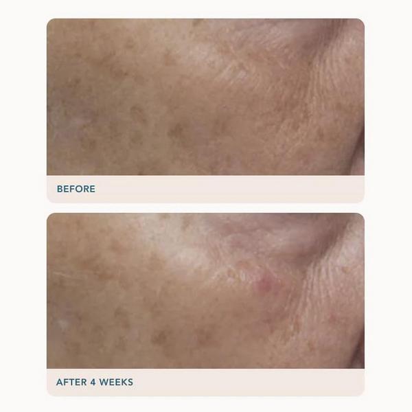 Lancer Skincare Gravity Dark Spot Correcting Serum #4