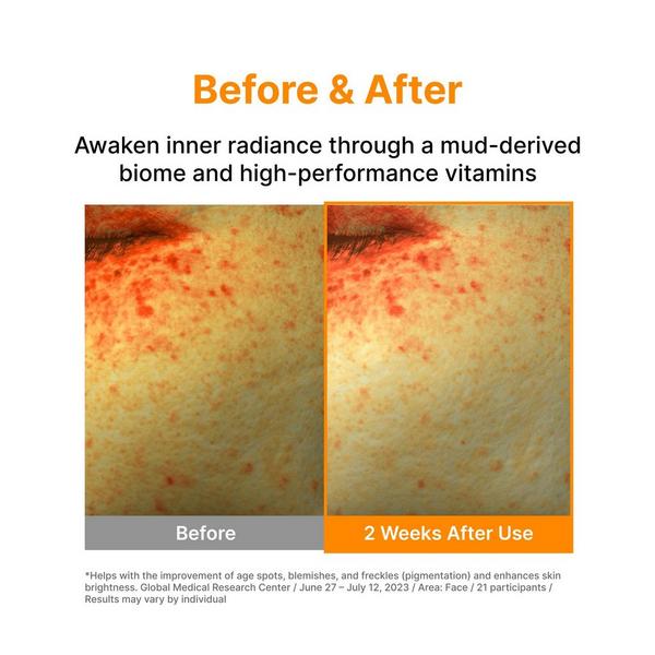 Madeca Derma Vita Brightening Microbiome Ampoule (5 ea) #8