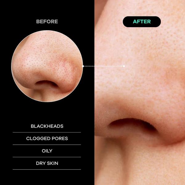 Dermasuri Deep Exfoliating Face Scrub Mitt #3