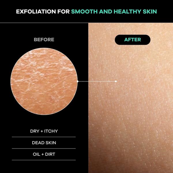 Dermasuri Deep Exfoliating Back Scrub #3