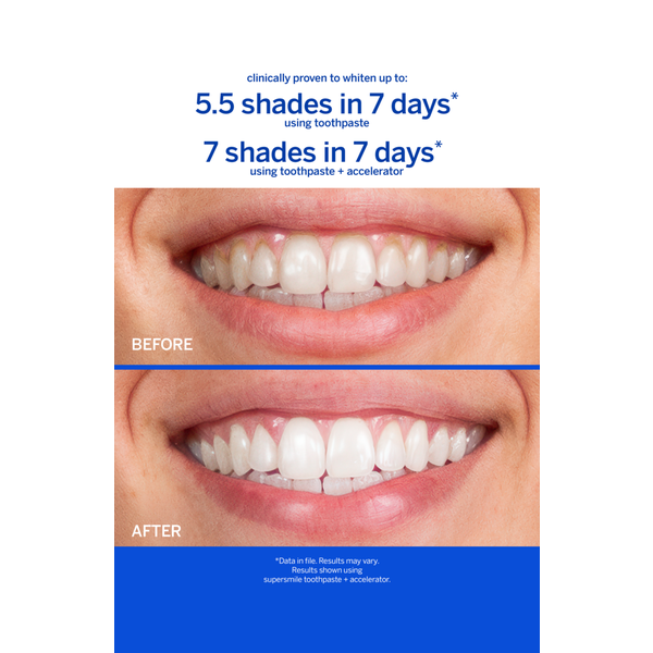 Supersmile Professional Whitening Toothpaste #4