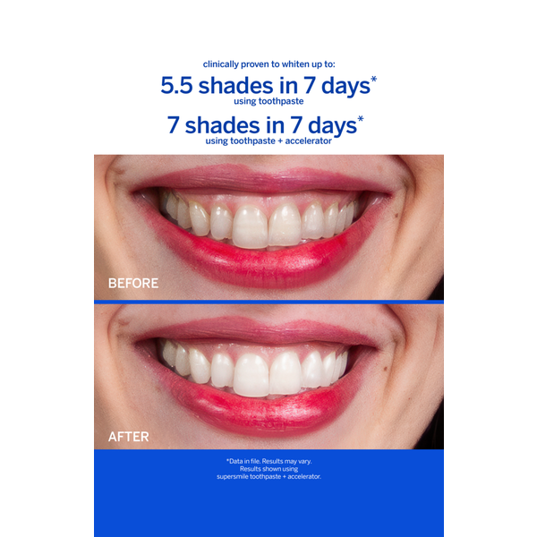 Supersmile Fluoride Free Professional Whitening Toothpaste #4