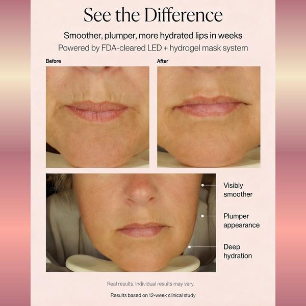 Metamorphosis LushLips Hydrogel Mask #6