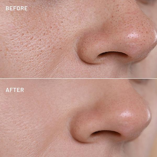 Dr. Brandt The Pore-Fect Set #3