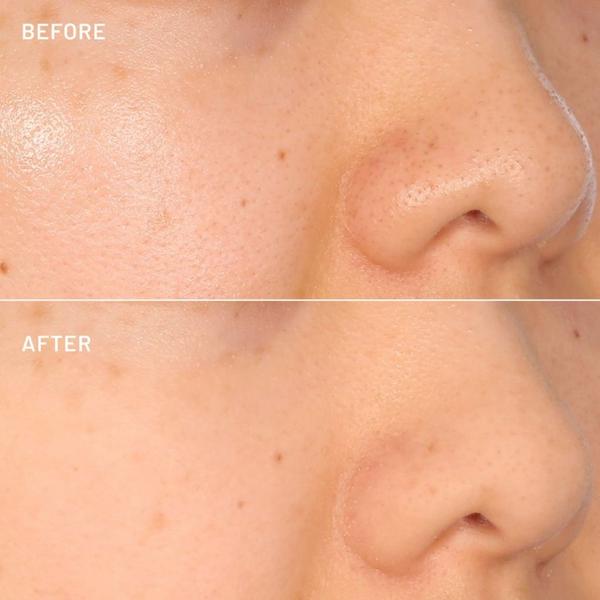 Dr. Brandt The Pore-Fect Set #5