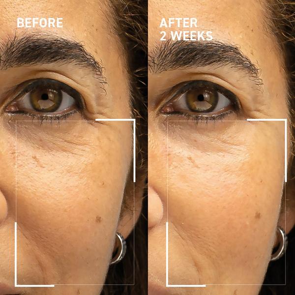 Dr. Brandt Microneedling Rejuvenating Kit #2