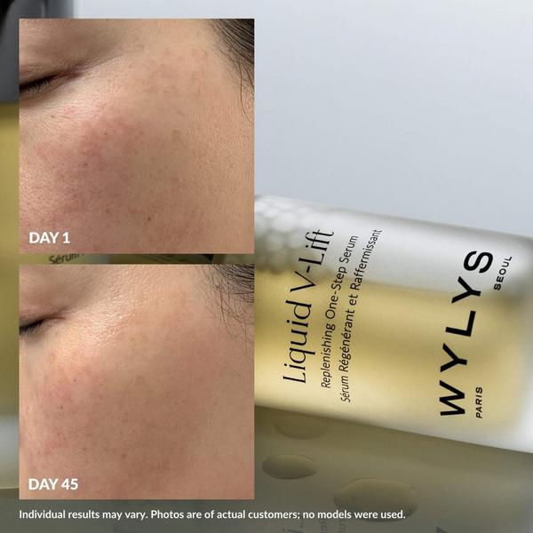 WYLYS Liquid V-Lift #5