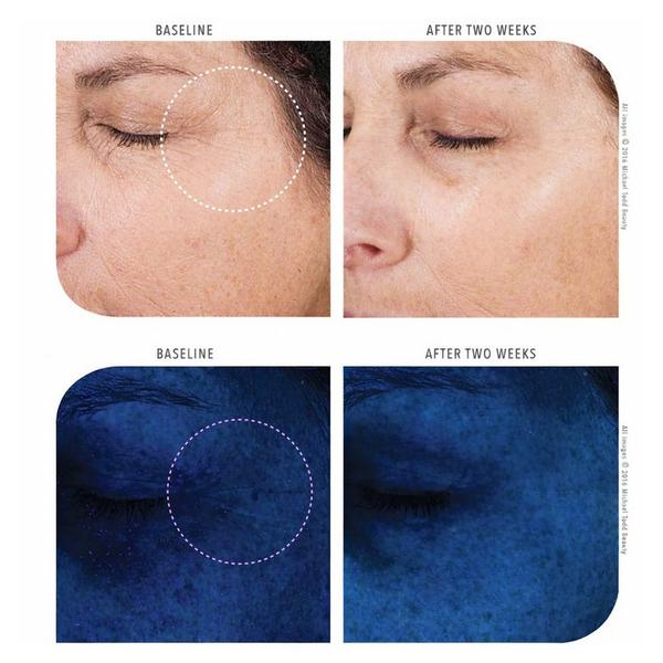 Michael Todd Beauty KNU Anti-aging Cream #5