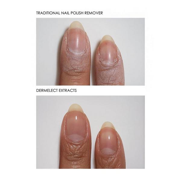 Dermelect Extracts 3-In-1 Soy Nail Polish Remover #3