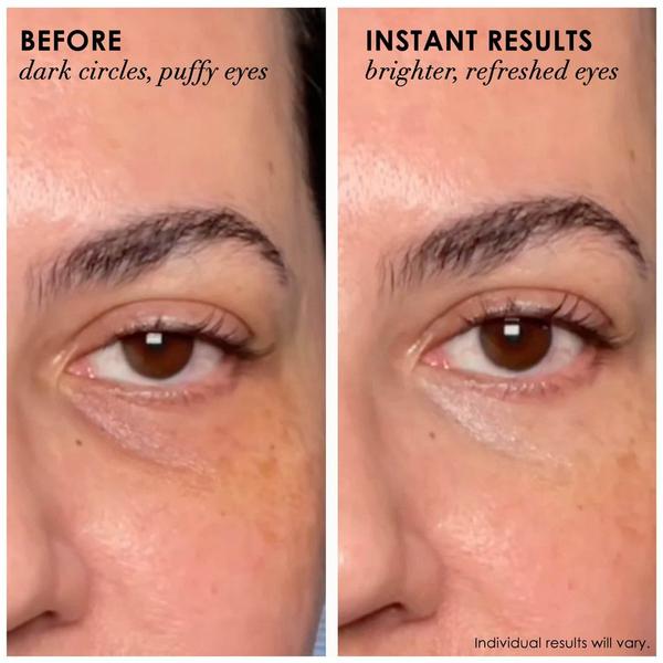 Dermelect Revitalite Professional Eyelid & Dark Circle Corrector #3