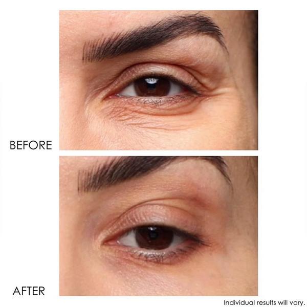 Dermelect Revitalite Professional Eyelid & Dark Circle Corrector #4