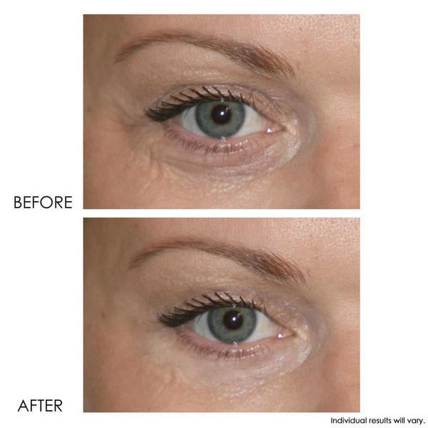 Dermelect Revitalite Professional Eyelid & Dark Circle Corrector #8