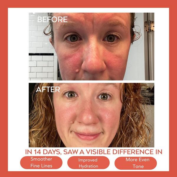 Bejou Hydrating Dew Moisturizer + Pureglow Facial Cleanser #3