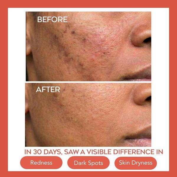 Bejou Hydrating Dew Moisturizer + Pureglow Facial Cleanser #4