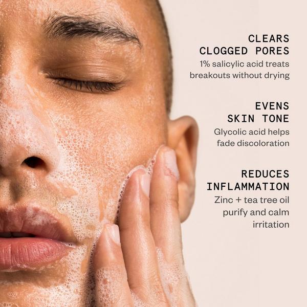 Hypothesis Acne Essentials Duo + Free Blemish Patches #3