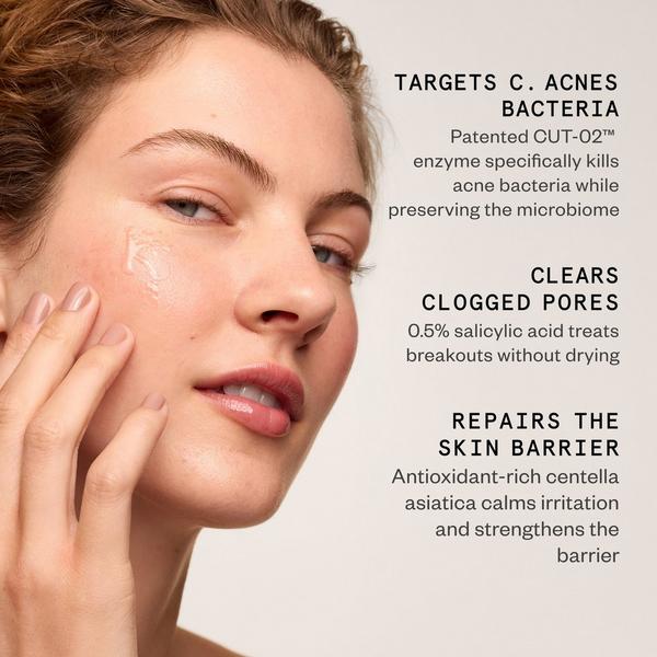 Hypothesis Acne Essentials Duo #4