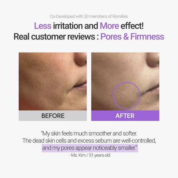 Rovectin Retinosine Deep Intense Cream #3