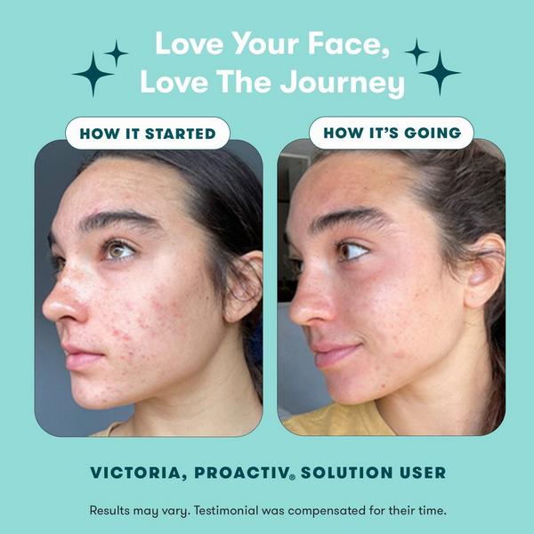 Proactiv Solution 3-Step Routine Minis #3