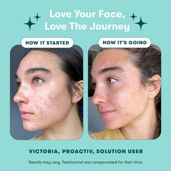 Proactiv Solution 3-Step Routine 30-Day Kit #5