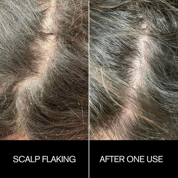 Najeau Sunday Scalp Mask #4