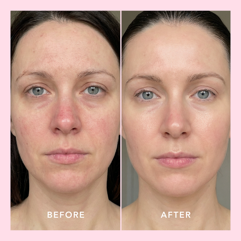Doll 10 - Let's Glow The Fixer Elixir with Exosomes | Ulta Beauty