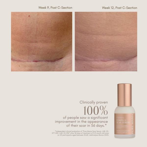 Pure Mama Complex Scar Serum #4